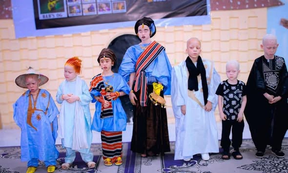 بلدية تفرغ زينة تشارك في إحياء اليوم الدولي للتوعية بالمهق